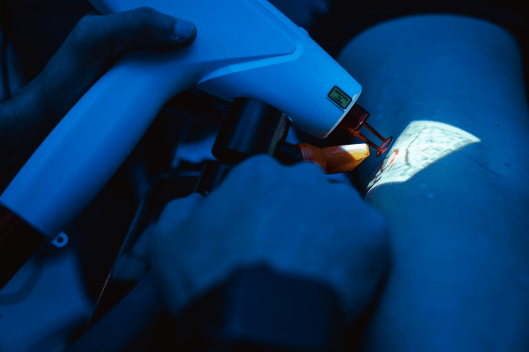Foto Vasinhos e nutridoras com laser Transdérmico